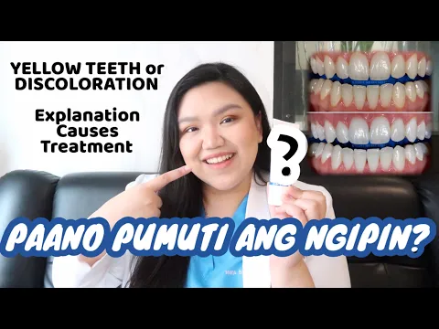 HOW TO WHITEN YOUR TEETH in an AFFORDABLE WAY 🦷✨ | Dr. Bianca Beley
