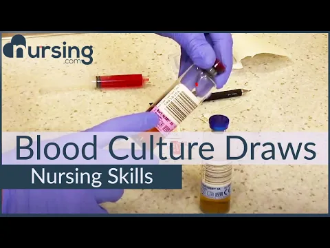 Blood Culture Draws- Top Priorities  (Nursing Skills)