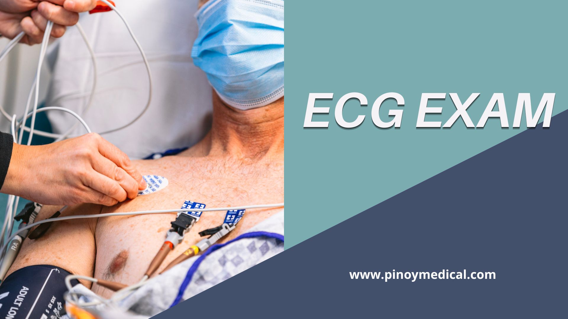 ECG Price in the Philippines 2024 — PinoyMedical