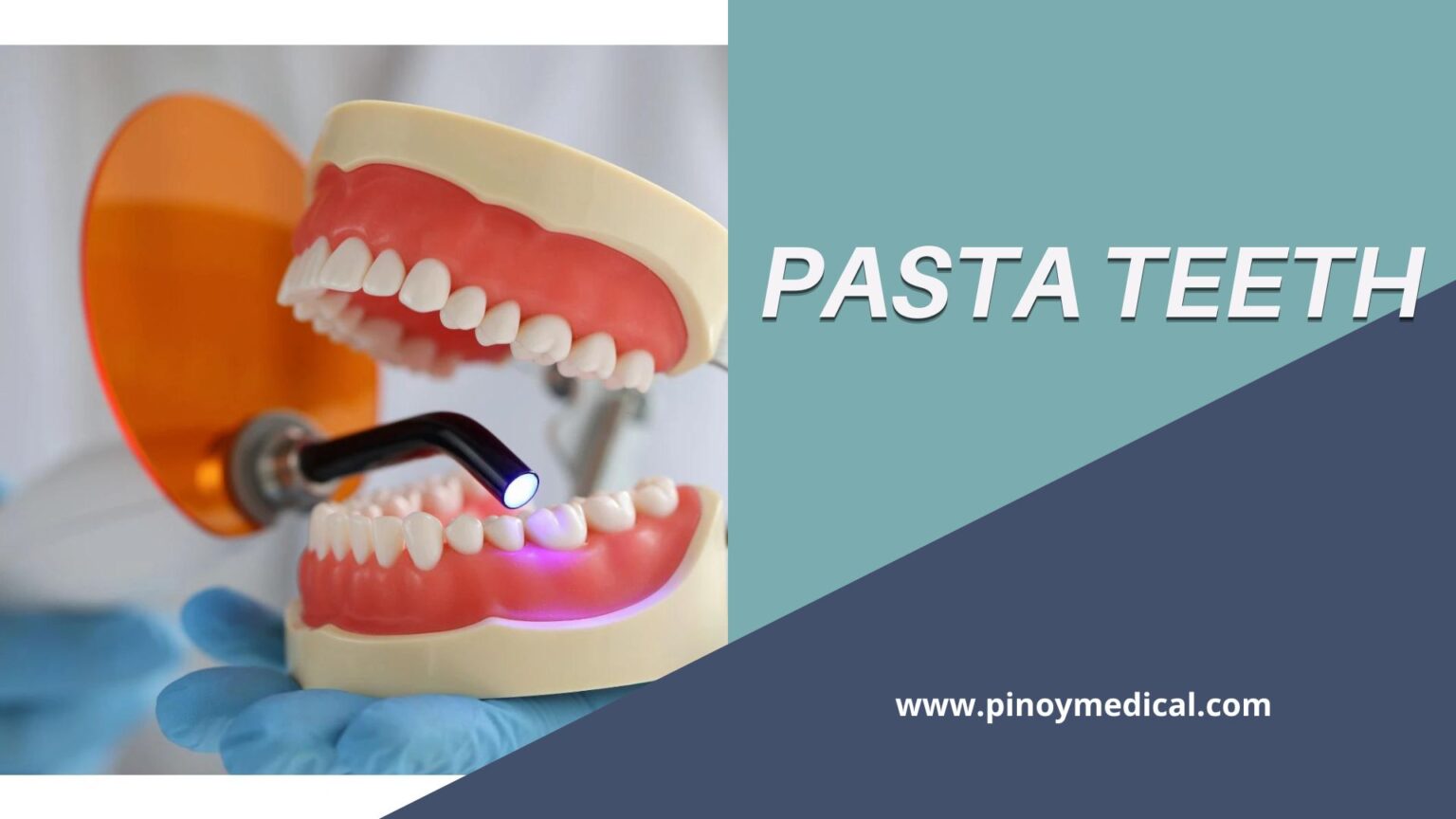 Pasta Teeth Price in the Philippines 2024 — PinoyMedical