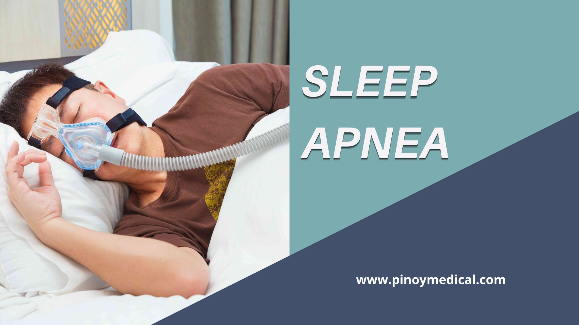 Sleep Apnea Test Price in the Philippines 2024 — PinoyMedical