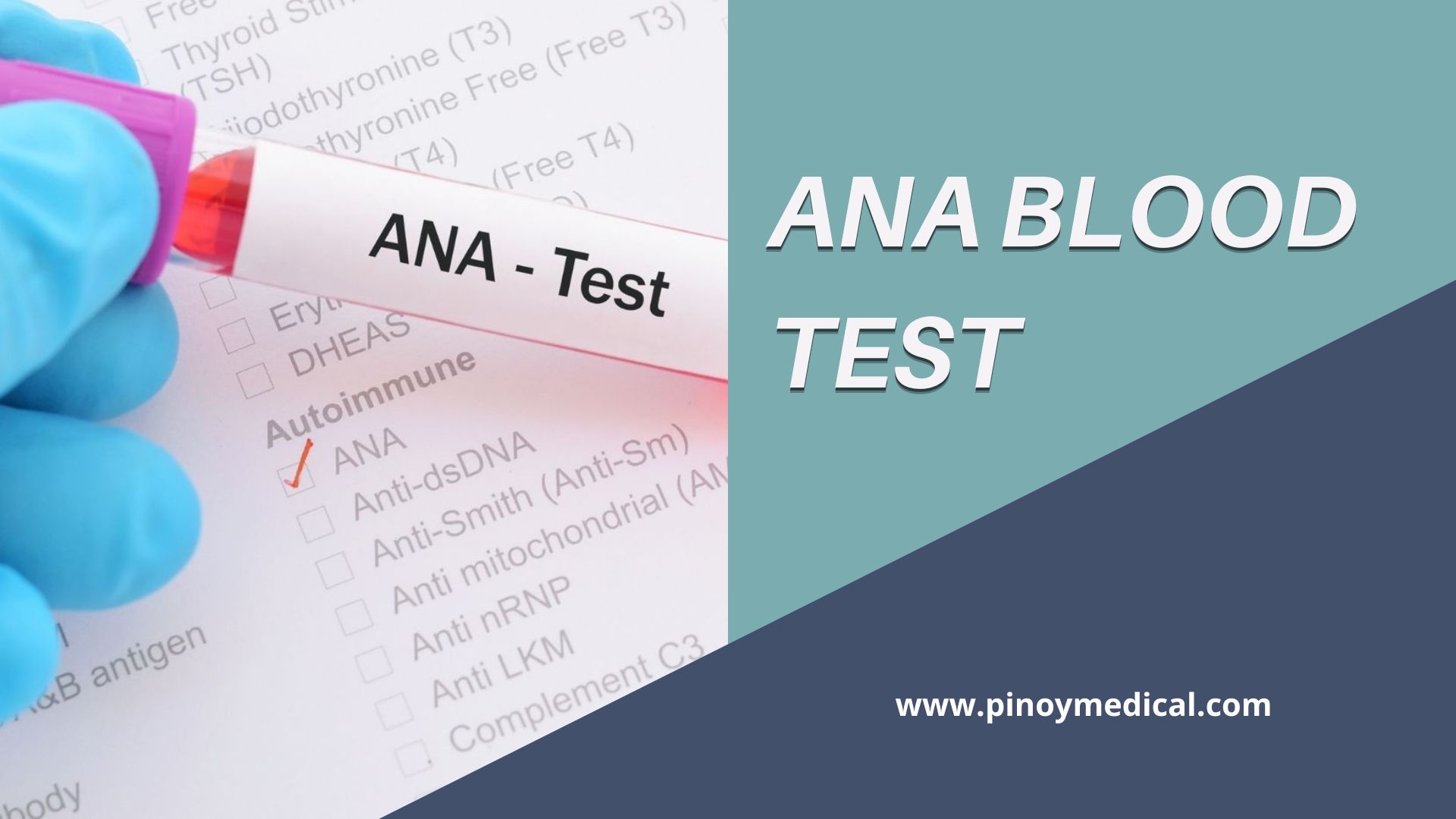 ANA Blood Test Price in the Philippines 2024 PinoyMedical