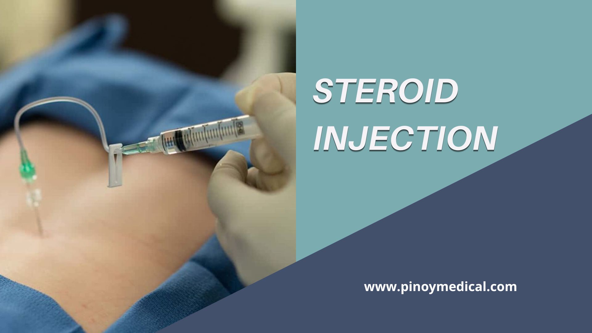 Steroid Injections Price in the Philippines 2024 — PinoyMedical