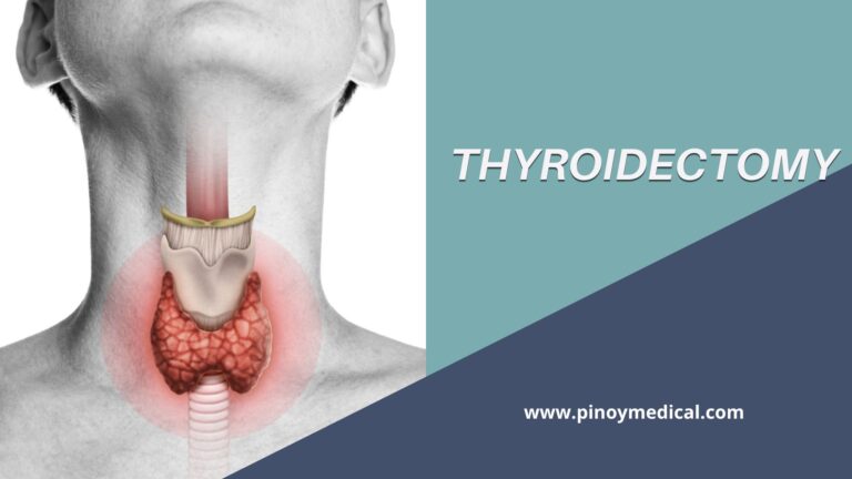 Thyroidectomy Price in the Philippines 2024 — PinoyMedical